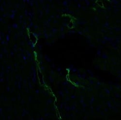 Podoplanin Antibody (LF3/B7/D5B27) - Azide and BSA Free, Novus Biologicals:Antibodies:Primary